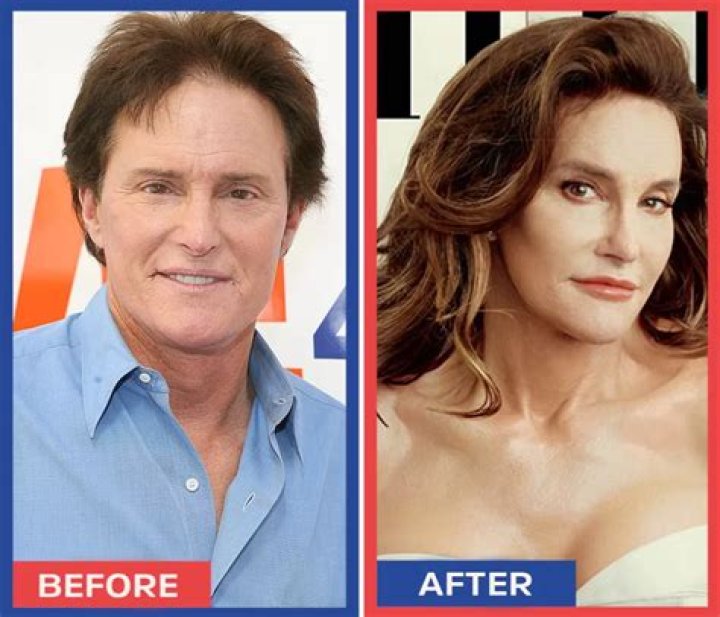 Caitlyn Jenner Considered a Sex Change Over 30 Years Ago, Reveals Ex-Wife Linda Thompson!