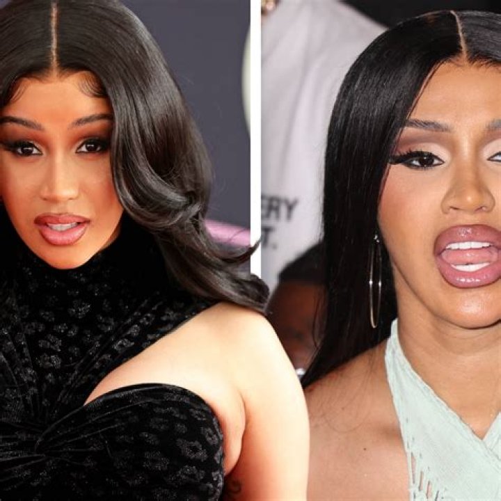 Cardi B Says She’ll Never Get Plastic Surgery Again!