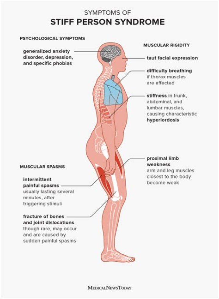 Celine Dion Has ‘Lost Control of Her Muscles’ Amid Her Battle With Stiff-Person Syndrome
