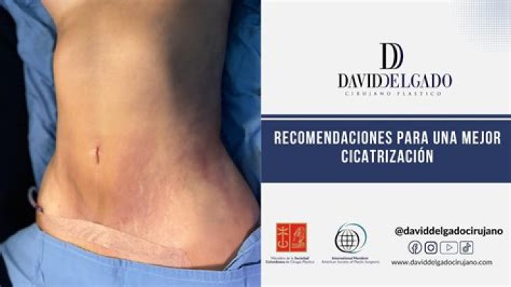 ¿Cuándo puedo usar sostén después de un tatuaje en el esternón?