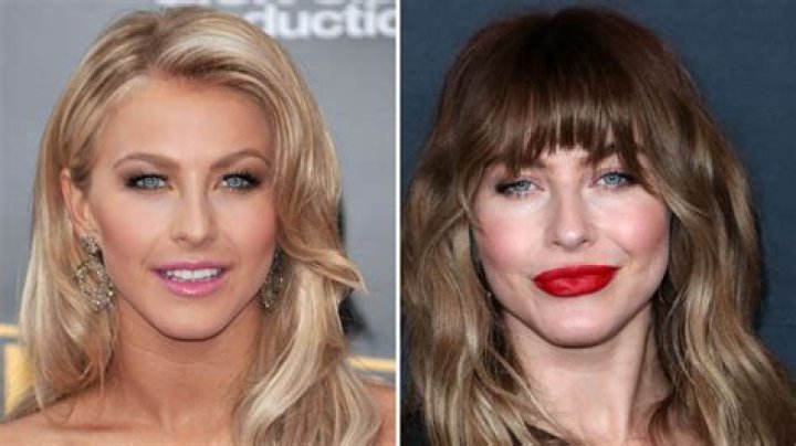 Has Julianne Hough Undergone Plastic Surgery: See Photos of Her Transformation