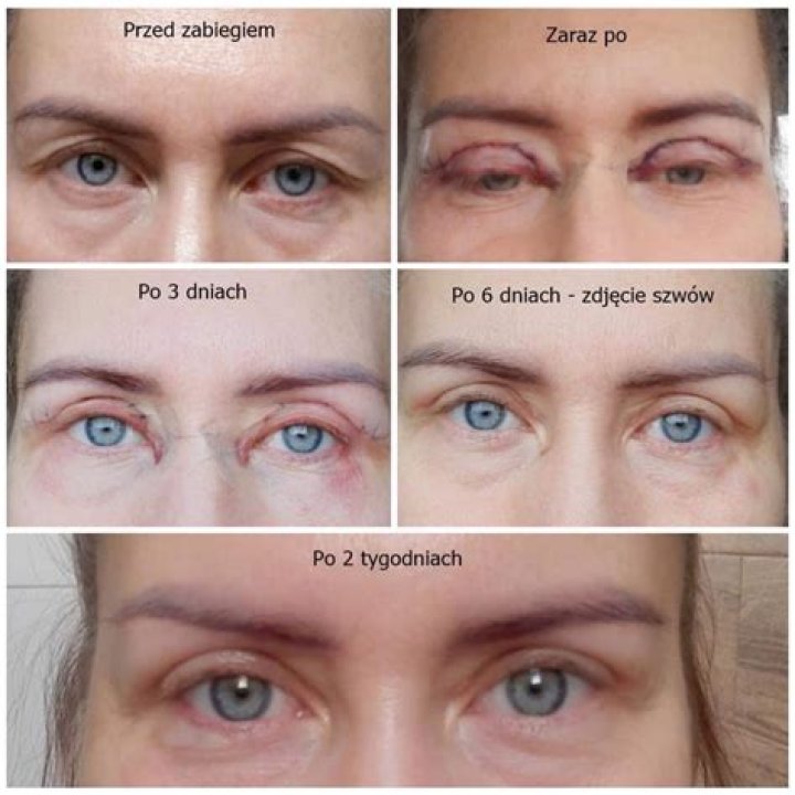 Jak uzyskać 4 galony wody przy użyciu 5 galonów i 3 galonów wiadra? – Celebrity.fm