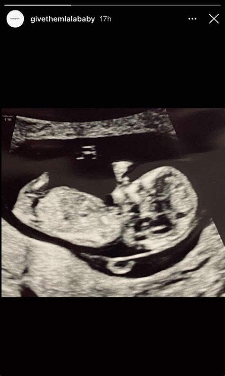 Pregnant Lala Kent Shares the 1st Sonogram of Her Unborn Child With Fiance Randall Emmett