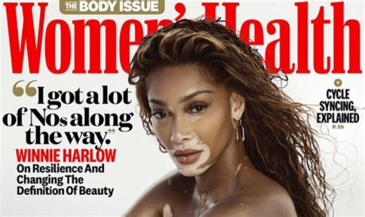 Winnie Harlow Poses Nude For "Women's Health" Cover Shoot: Photos