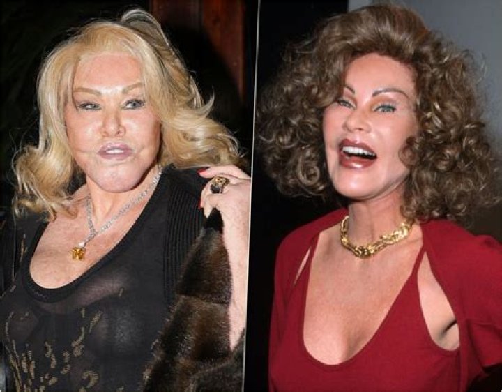Yikes!“Catwoman” Jocelyn Wildenstein Arrested After Slashing Boyfriend With Scissors!